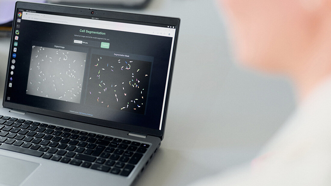 KI_Zellsegmentierung.jpg KI Zellsegmentierung
