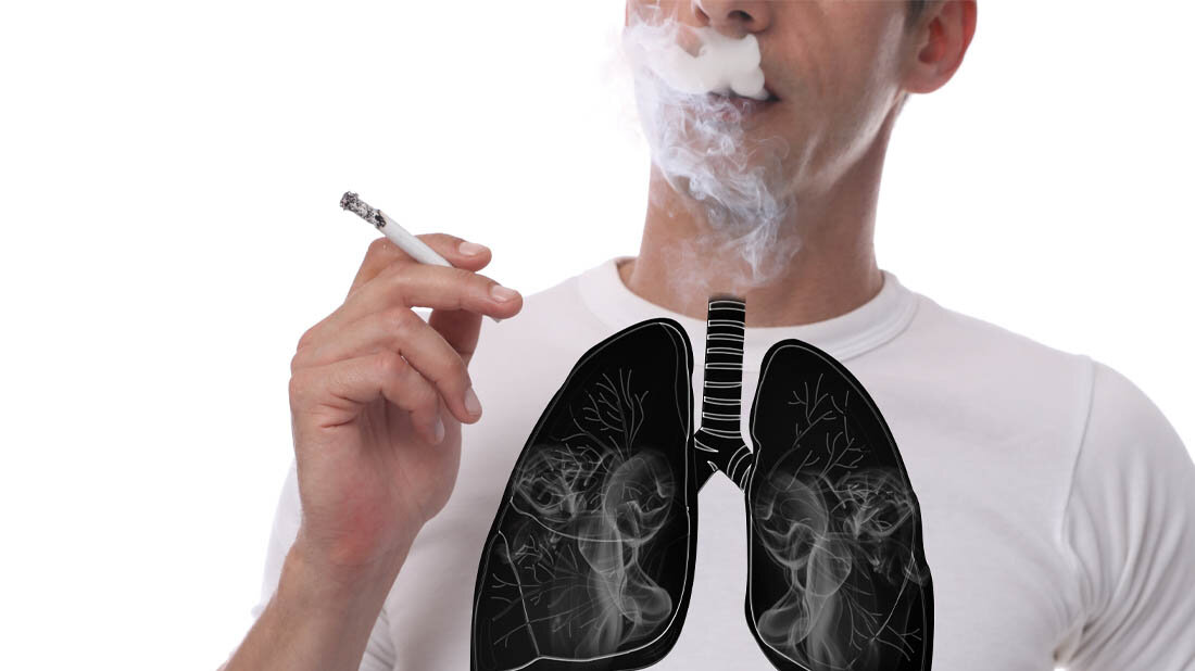 COPD_Rauchen.jpg Raucher