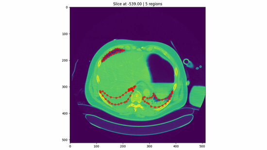 Segmentierung Von Lungen CT Bildern In Rekordzeit MT Dialog