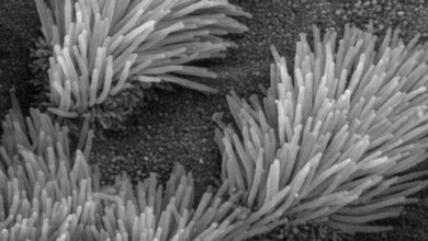 Labordiagnostik Mukoviszidose