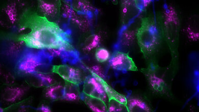 Pilzinfektion_Lunge.jpg Neuer Ansatz gegen Pilzinfektionen der Lunge