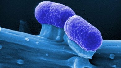 Probiotische_E_coli_Bakterien_HZI_Rohde_06042016.jpg Probiotische E. coli-Bakterien