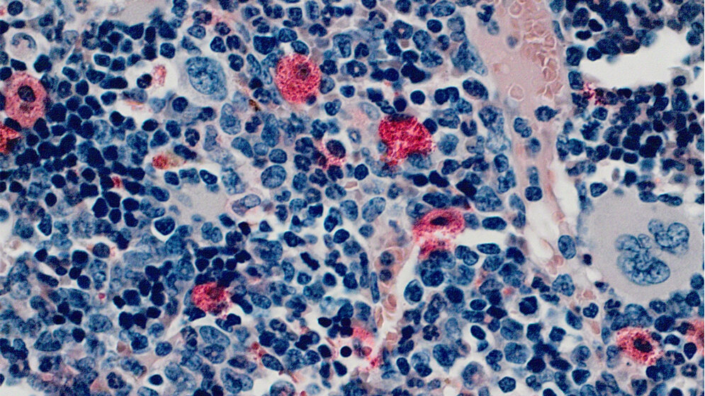 Blutbildende_Zellen_des_Knochenmarks_Konrad_Aumann_21062016.jpg Blutbildende Zellen des Knochenmarks.