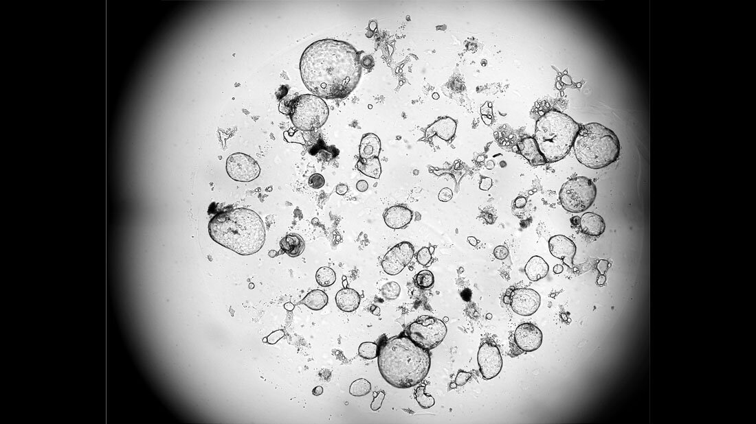 Ausgeschuettete_Faktoren_von_aktivierten_Killer_T_Zellen.jpg Funktion der Killer-T-Zellen