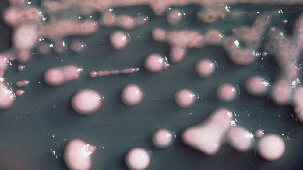 K_pneumoniae_auf_MacConkey_Agar_Public_Domain.jpg K. pneumoniae