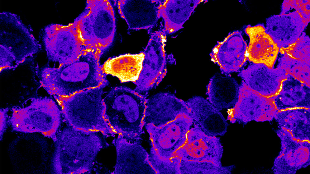 Photoschaltbare_Fettsaeuren_D_Trauner_27072016.jpg Photoschaltbare Fettsäuren