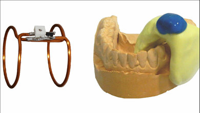 Doppelspule_aus_Kupfer_mit_deutlich_praeziseren_MRT_Bildern_Ludwig_et_al_Scientific_Reports_31052016.jpg präzisere MRT-Bilder