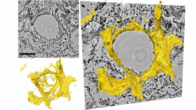 Schnitte_durch_das_dreidimensionale_Rekonstruktionsvolumen_Tim_Salditt_Marina_Eckermann.jpg Schnitte durch das dreidimensionale Rekonstruktionsvolumen