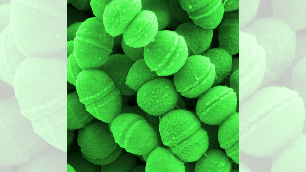 Streptococcus_Arten_koennen_nekrotisierende_Fasziitis_ausloesen_HZI_Manfred_Rohde.jpg Streptococcus-Arten