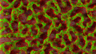 Biofilm_eines_klinischen_Isolates_von_Pseudomonas_aeruginosa_TWINCORE_Janne_Thoeming.jpg Biofilm eines klinischen Isolates