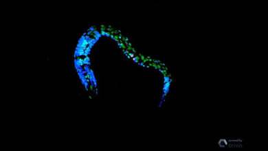 konfokale_Mikroskopie_von_C_elegans_nach_UV_Bestrahlung_Dr_Siyao_Wang.jpg konfokale Mikroskopie von C. elegans nach UV-Bestrahlung