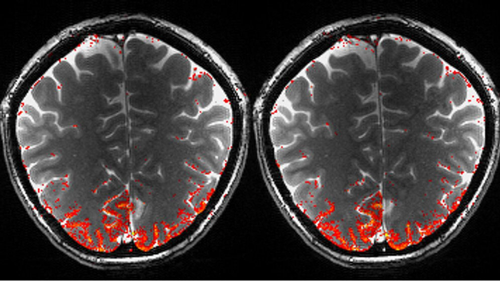 Aktivierung_des_visuellen_Kortex_gemessen_bei_9_4_T_Max_Planck_Institut_fuer_biologische_Kybernetik.jpg Aktivierung des visuellen Kortex