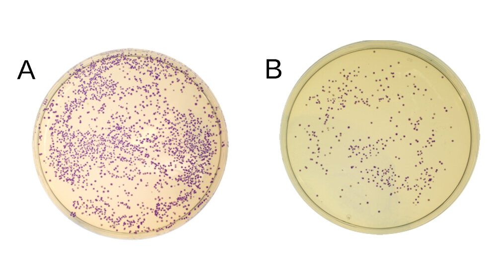 E_Coli_Bakterien_die_blaues_Protein_produzieren_Fotos_David_Oliver_Richter.jpg E. Coli-Bakterien, die blaues Protein produzieren