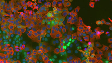Infektion_Corona.jpg Mikroskopisches Bild mit Zellkernen in blau mit roter Umrandung (Coronavirus) und grünen Punkten (Kinase-Aktivitätsreporter) auf dunkelgrünem Hintergrund