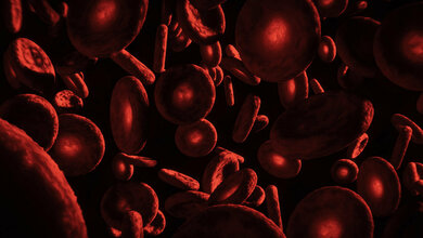 Blut_Adobe.jpg Warum entstehen Antikörper bei Hämophilie A