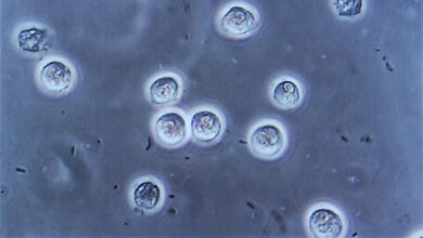 Stabfoermige_Bakterien_Infektion_der_Harnwege_Steven_Fruitsmaak_CC_BY_SA_3_0.jpg Anzeichen für eine Infektion der Harnwege