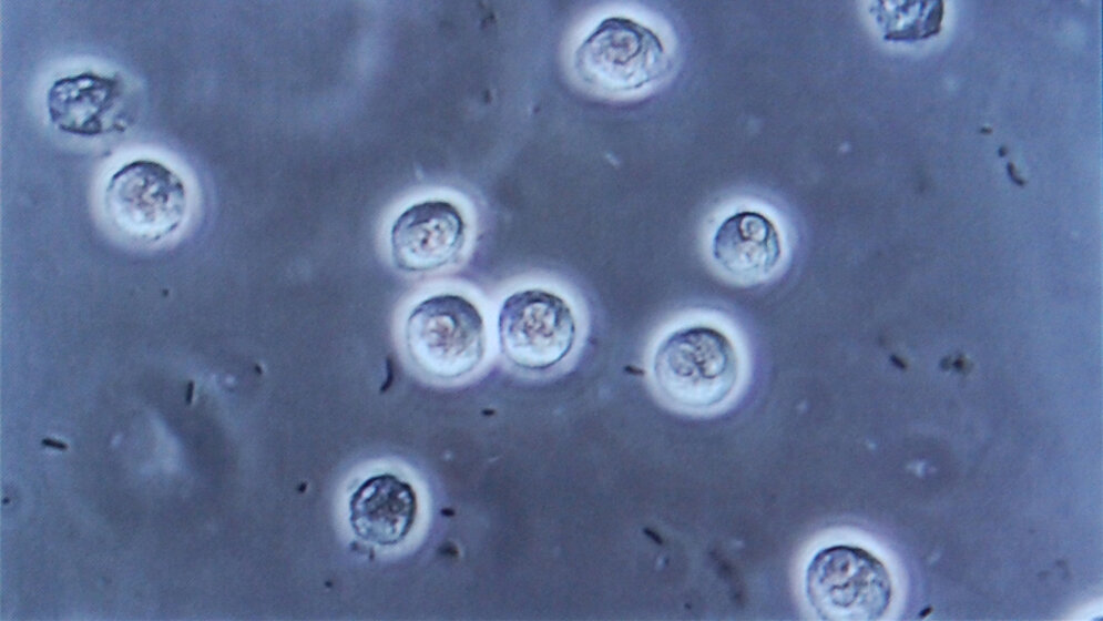 Stabfoermige_Bakterien_Infektion_der_Harnwege_Steven_Fruitsmaak_CC_BY_SA_3_0.jpg Anzeichen für eine Infektion der Harnwege