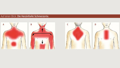 Die_Herzinfarkt_Schmerzorte_Illustrationen_DHS_Jan_Neuffer.jpg Die Herzinfarkt-Schmerzorte.