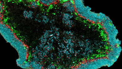 Netzhaut_Organoid_unter_dem_Mikroskop_CRTD_18042016.jpg Netzhaut-Organoid