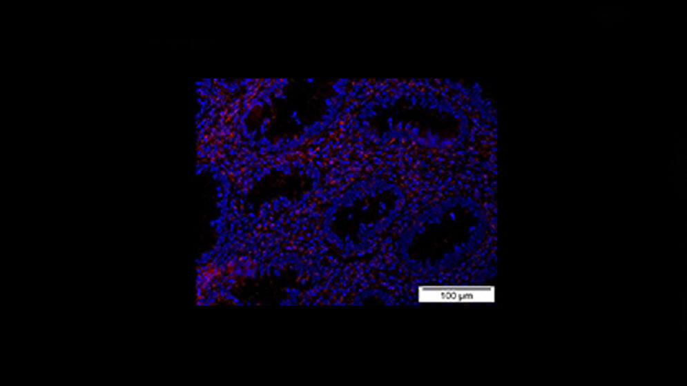 Protein_Bcl_3_rot_fuehrt_zu_chronischen_Entzuendungen.jpg Protein Bcl-3
