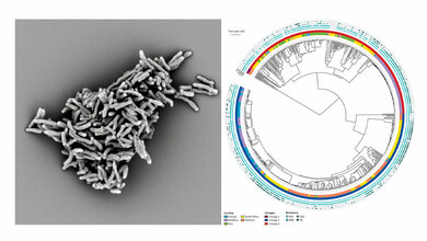Tbc.jpg Elektronenmikroskopische Aufnahme von Mycobacterium tuberculosis
