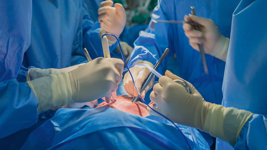 Mycobacterium chimaera Titelbild zum Fachbeitrag über Mycobacterium chimaera, einen ungewöhnlichen Erreger