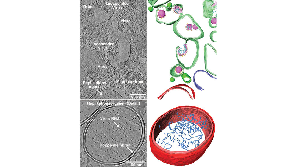 Die_mit_Kryo_Elektronenmikroskopen_entstandenen_Aufnahmen_Uniklinik_HD.jpg Kryo-Elektronenmikroskop