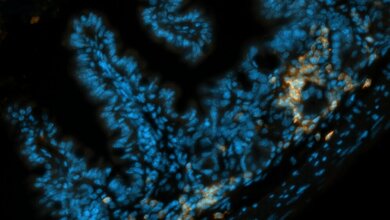 schnitt_durch_duenndarm_Blau_Zellkerne_Darmzellen_Orange_Immunzellen_R_Zeiser_Universitaetsklinikum_Freiburg_18032016.jpg Schnitt durch den Dünndarm