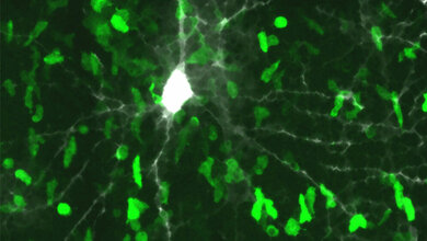 Beta_Synuclein_erkennende_T_Zellen_stuermen_die_graue_Hirnsubstanz_Institut_für_Neuroimmunologie_und_MS_Forschung_Goettingen.jpg Beta-Synuclein-erkennende T-Zellen