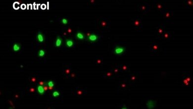Alpha_Synuklein_Ansammlungen_gruen_toxisch_fuehren_zum_Zelltod_rot_Prof_Outeiro_CNMPB_18032016.jpg α-Synuklein-Ansammlungen