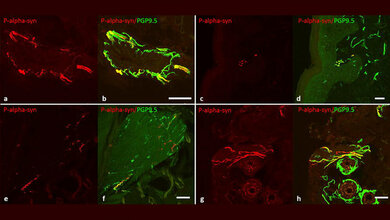 Konfokale_Mikrophotographien_Kathrin_Doppler_Hanna_Maria_Jentschke_Lena_Schulmeyer_et_al.jpg Konfokale Mikrophotographien