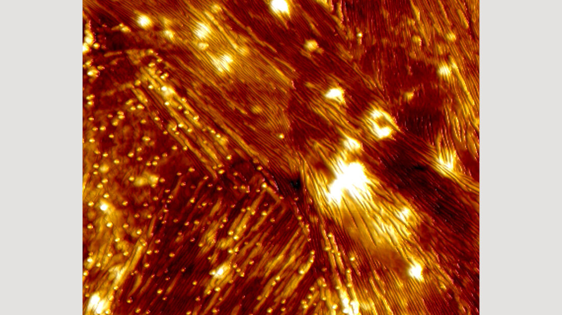 Fibrillenaktivitaet.jpg Fibrillenaktivität