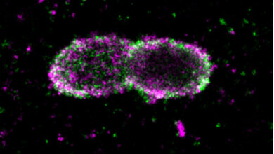 Salmonellen_Bakterien_in_menschlicher_Zelle_Mike_Heilemann_Ivan_Dikic.jpg Salmonellen-Bakterien