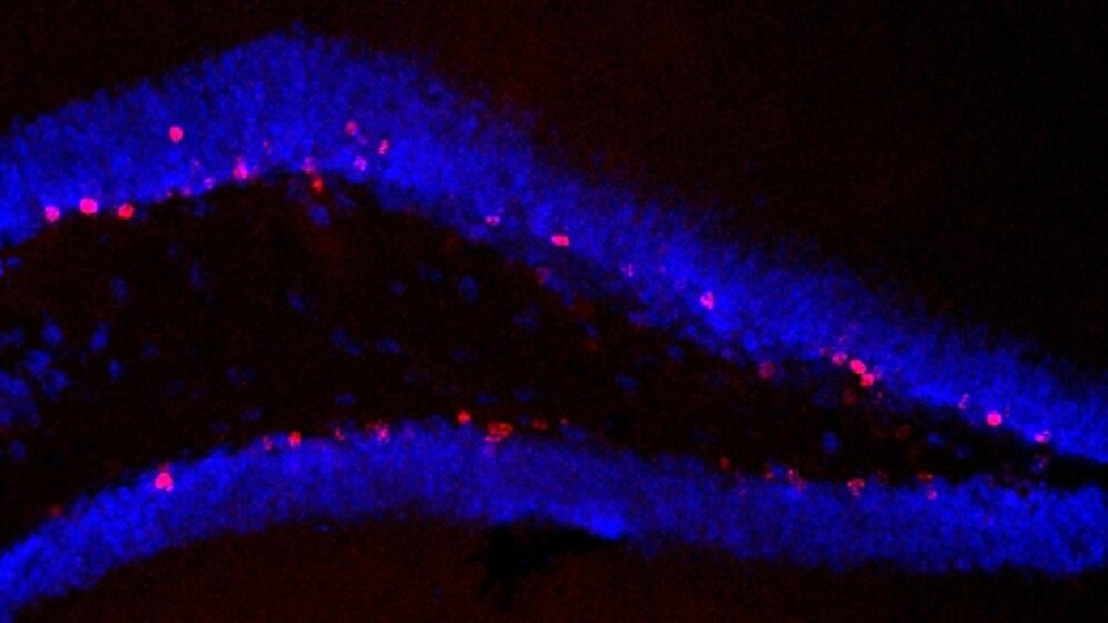 Hippocampus_unbehandelter_Tiere_die_trainiert_haben_Zahlreiche_Zellen_neu_rot_gebildet_Bild_Susanne_Wolf_MDC_20052016.jpg Hippocampus von unbehandelten Tieren