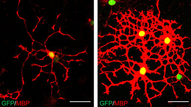 Oligodendrocyten_AGs_Quing_Richard_Lu___Evi_Kostenis_Cincinnati_Children’s_Hospital_Medical_Center___Universität_Bonn.jpg Oligodendrozyten