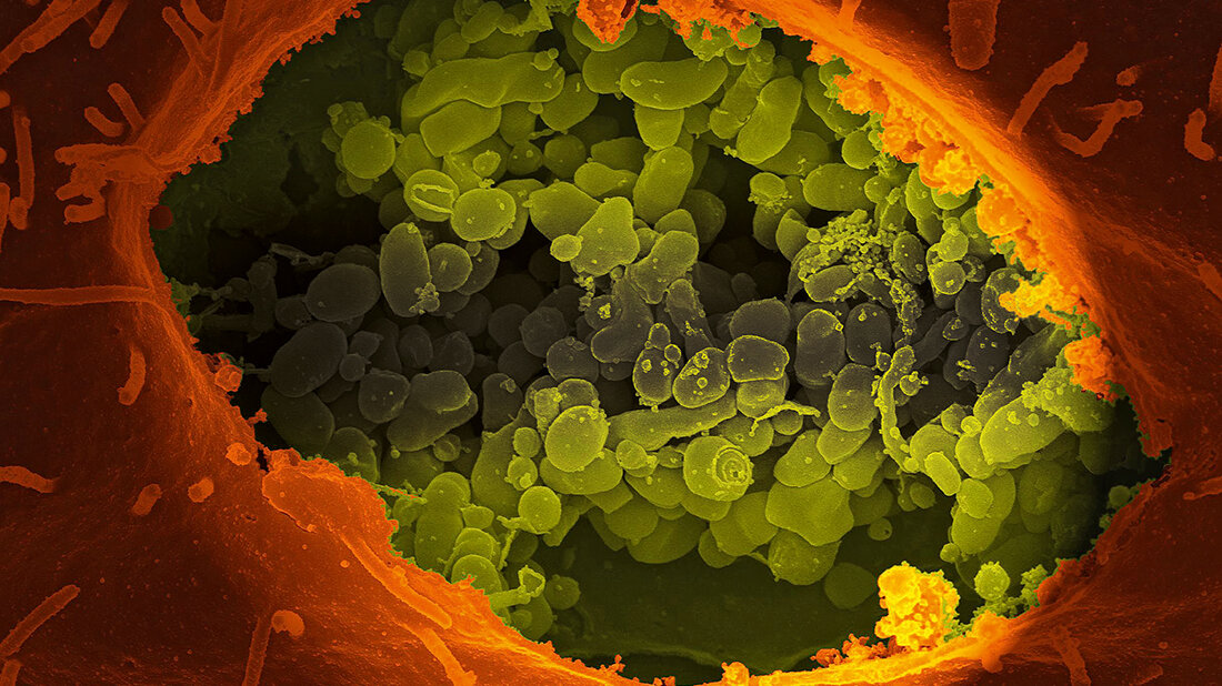 Q-Fieber Titelbild zum Fachbeitrag über das sogenannte Q-Fieber