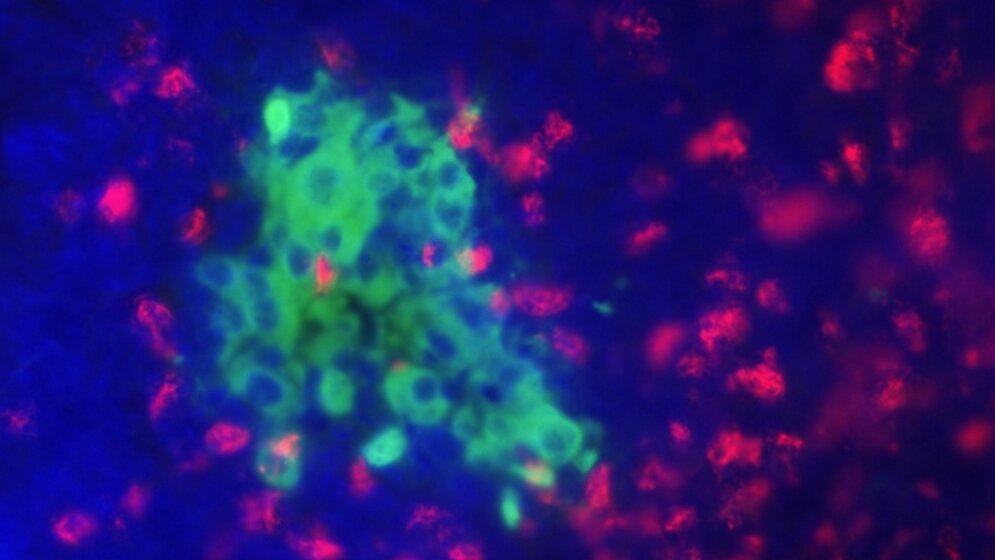 Optimierte_Insulin_Bausteine_Helmholtz_Zentrum_Muenchen_16032016.jpg Optimierte Insulin-Bausteine