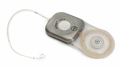 Aus der Industrie Cochlea-Implantate und MRT