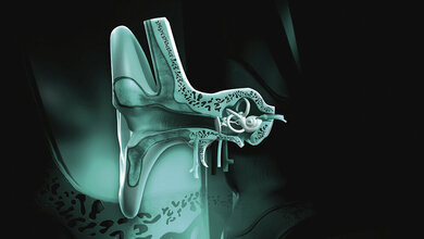 Funktionsdiagnostik Pädaudiologie