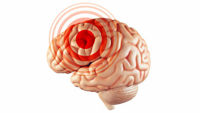 Gehirntumor_01.jpg Symbolbild für Hirntumor