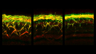 RSOM_Aufnahmen.jpg RSOM-Aufnahmen der Haut