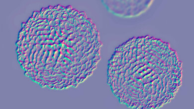 WNV_Adobe.jpg West-Nil-Virus