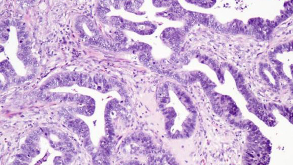 Histologie Screening-Programme