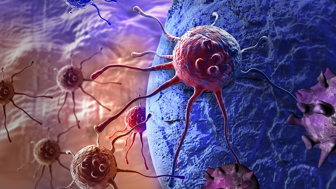 krebszellen.jpg Fähigkeit der Krebszellen, die Enden ihrer Chromosomen, die Telomere, zu verlängern