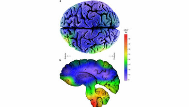 Konzentrationen_magnetischer_Kristalle_im_menschlichen_Gehirn_Stuart_A_Gilder_LMU_in_Scientific_Reports_2018.jpg unterschiedliche Konzentrationen magnetischer Kristalle