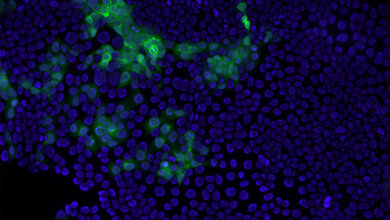 Gruene_Immunfaerbung_Hepatitis_E_Virus_Kapsidprotein_Leonard_Knegendorf_TWINCORE.jpg grüne Immunfärbung des Hepatitis E Virus Kapsidproteins