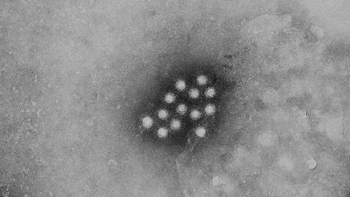 Virion_des_Hepatitis_A_Virus_CDC_Betty_Partin_gemeinfrei.jpg Virion des Hepatitis-A-Virus