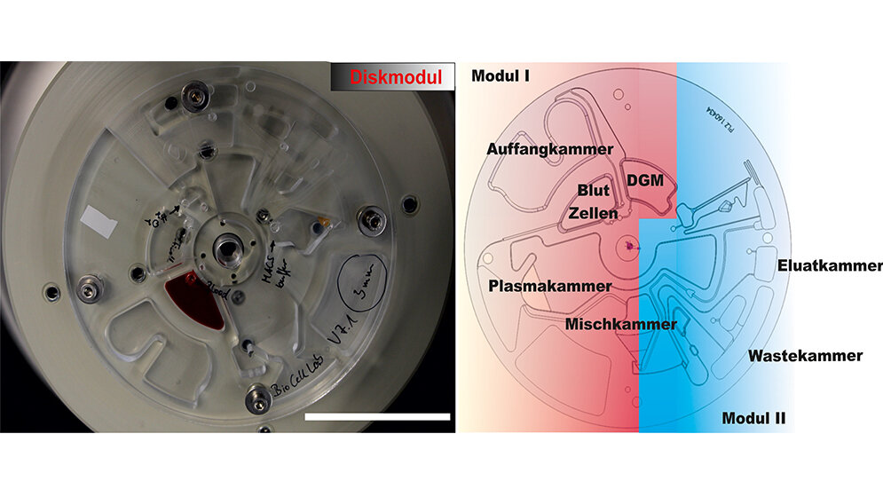 Zellseparator_iba_Heiligenstadt.jpg Diskplattform