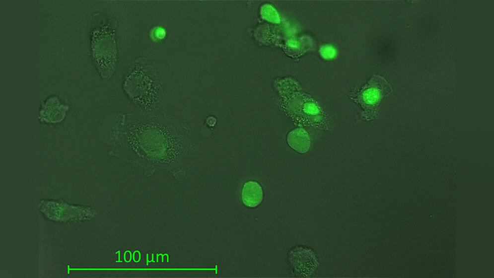 Makrophagen_verschlingen_Tumorzellen_Dr_Fotini_Vogiatzi.jpg Makrophagen verschlingen Tumorzellen