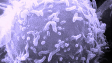 Rasterelektronenmikroskopische_Aufnahme_eines_Lymphozyten_Dr_Triche_National_Cancer_Institute_gemeinfrei.jpg Lymphozyt